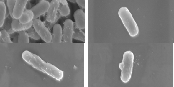 上面細菌照片未經過電漿處理之大腸桿菌，箭頭細菌明顯死亡為電漿處理後大腸桿菌的電子顯微鏡照片